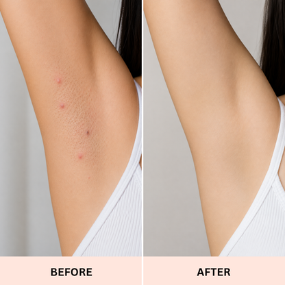 Bikini Trimmer for Women